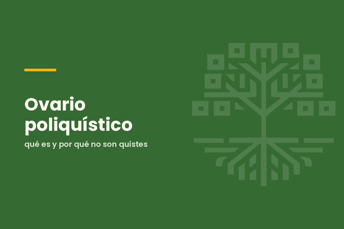Ovario poliquístico: qué es y por qué no son quistes