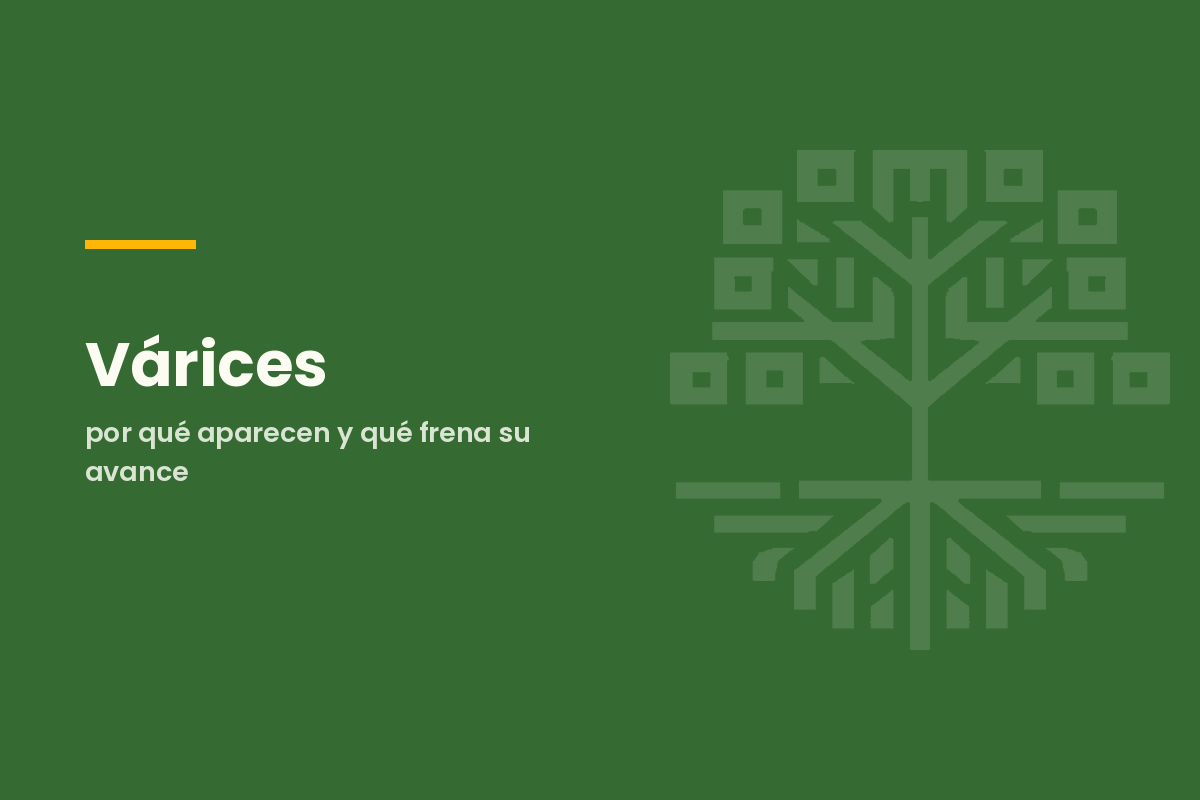 Várices: por qué aparecen y qué frena su avance